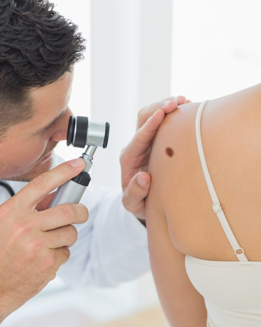 Male doctor examining mole on back of woman in clinic
