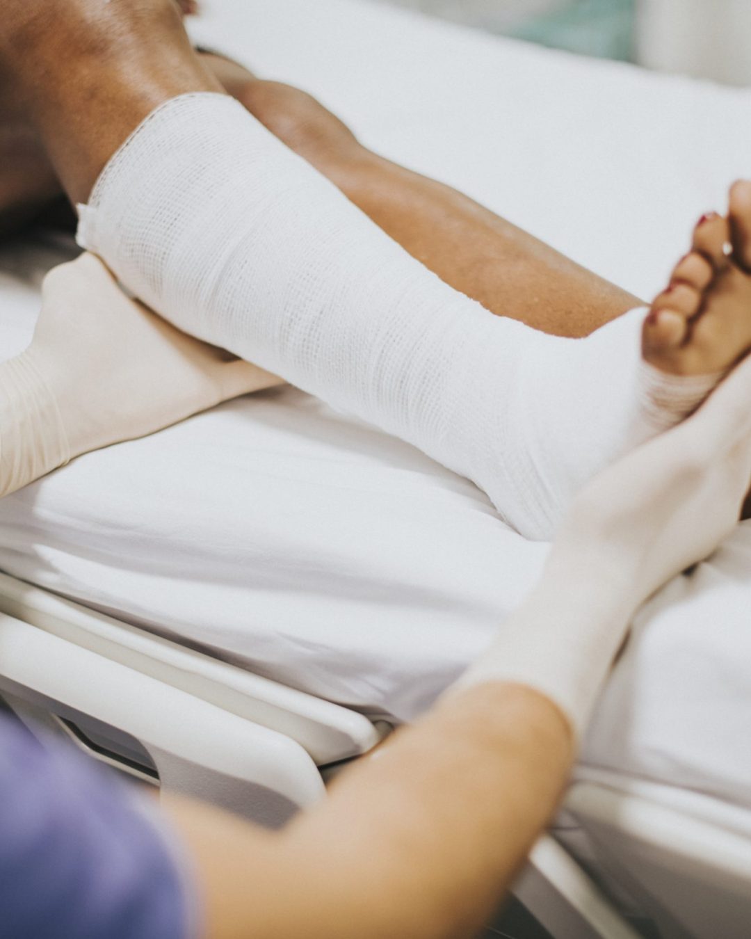 Doctor helping a patient with a fractured leg