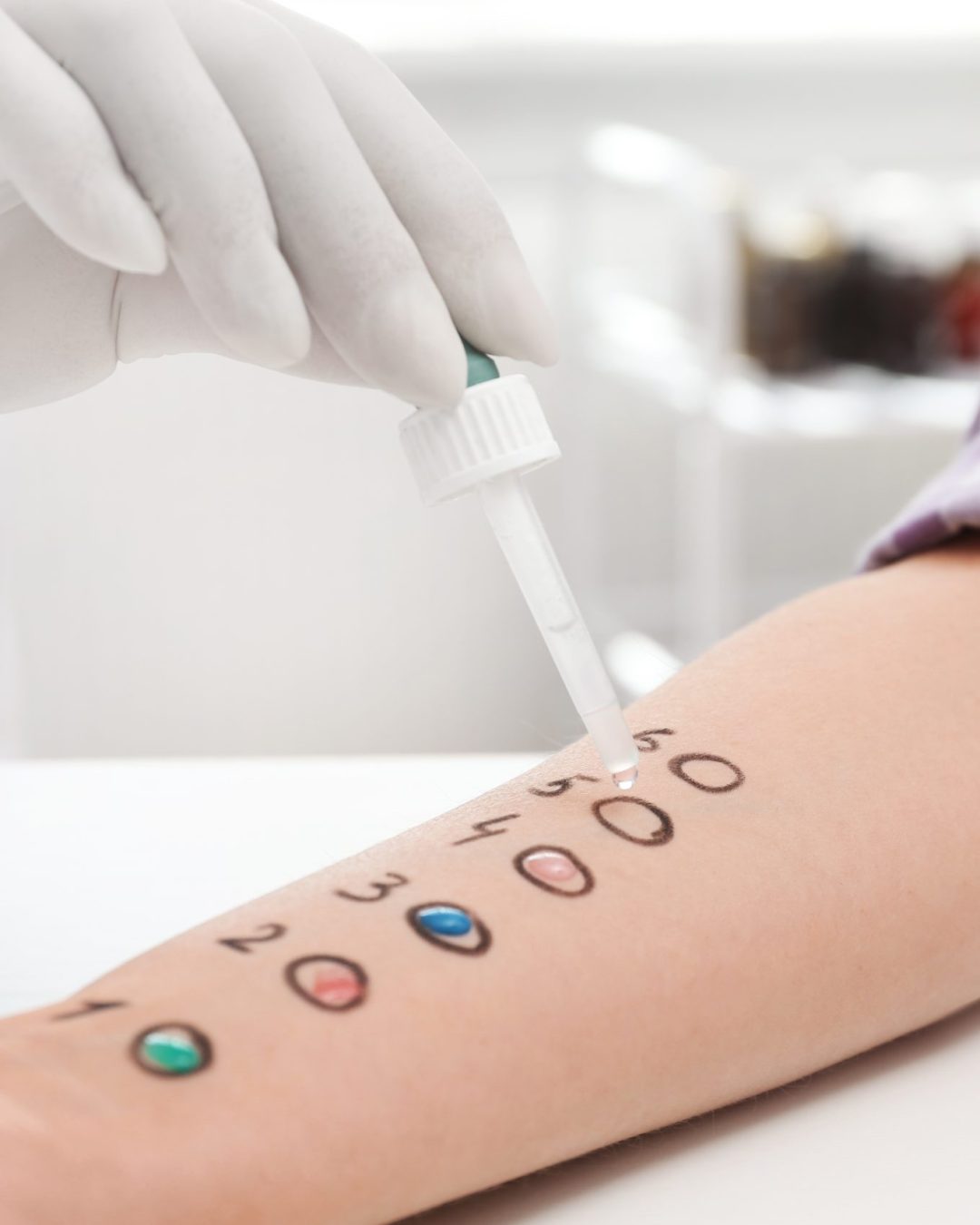 Patient undergoing skin allergy test at light table, closeup